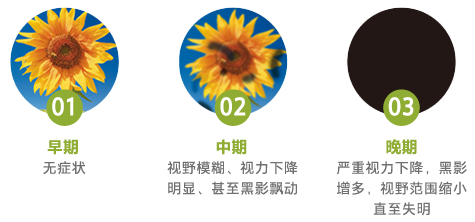 糖尿病眼病門(mén)診