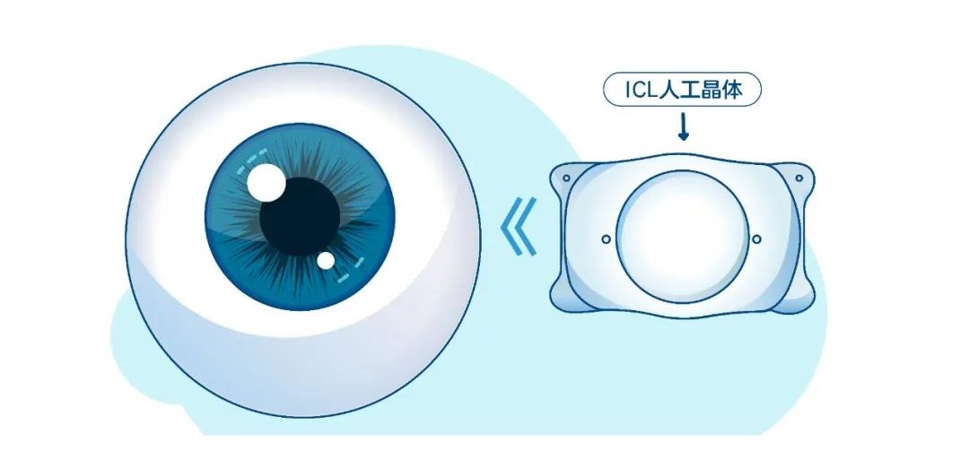 圖片.png 圖片.png